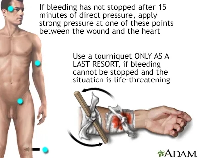 Stop The Bleed Month